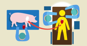 70 Years Since the First Kidney Transplant, Pig-to-human Option Gains Attention